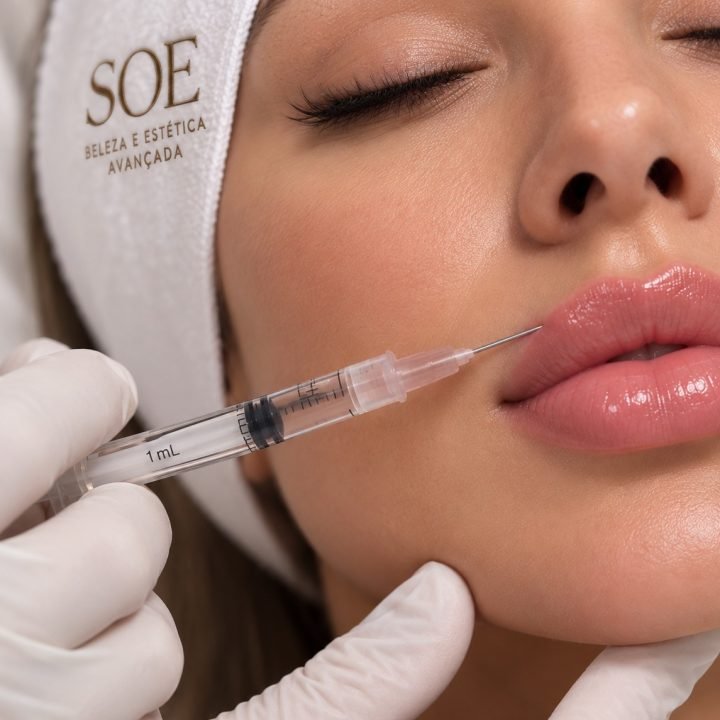 Preenchimento Labial